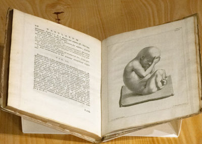 Uteri humani gravidi anatome et historia by Wilhelm Noortwyk