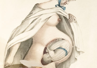Supplement to obstetric tables by G. (George) Spratt