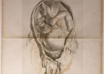 The anatomy of the human gravid uterus exhibited in figures by William Hunter