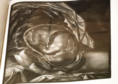 Abbildung der Gebähr-Mutter aus einer schwangern Frau by Charles Nicholas Jenty