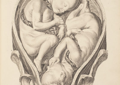 A set of anatomical tables, with explanations, and an abridgment, of the practice of midwifery by William Smellie